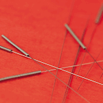 Acupuncture Needles